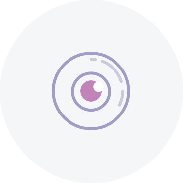 Eye abnormalities (corneal whorling)